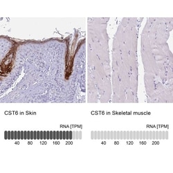 Cystatin E/M/CST6 Antibody, Novus Biologicals:Antibodies:Primary Antibodies